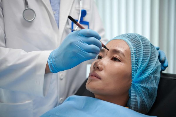 Mon parcours de transformation : choisir la chirurgie esthétique